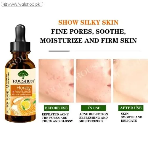 Roushun Lemon Honey Anti Acne And Brightening Face Serum